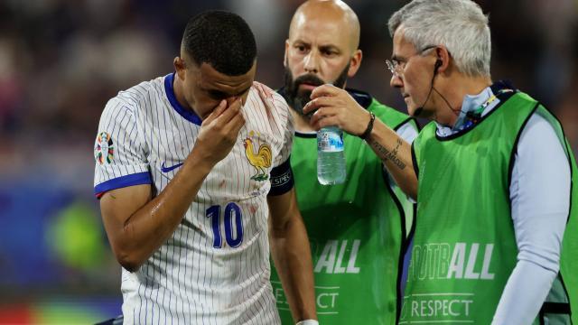 博鱼电竞官方网站-姆巴佩鼻骨骨折但暂无需手术 或缺席2场小组赛